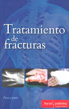 TRATAMIENTO DE FRACTURAS