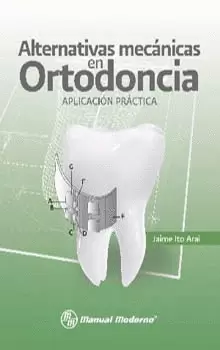 ALTERNATIVAS MECANICAS EN ORTODONCIA