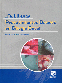 ATLAS PROCEDIMIENTOS BASICOS EN CIRUGIA BUCAL