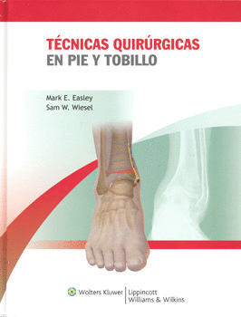 TÉCNICAS QUIRÚRGICAS EN PIE Y TOBILLO