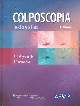 COLPOSCOPÍA TEXTO Y ATLAS