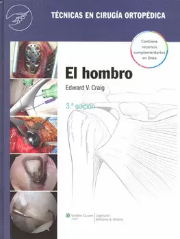 TÉCNICAS EN CÍRUGIA ORTOPÉDICA EL HOMBRO