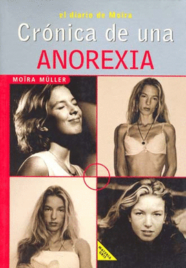 CRONICA DE UNA ANOREXIA