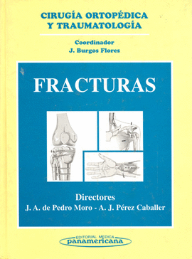 FRACTURAS CIRUGIA ORTOPEDICA Y TRAUMATOLOGIA