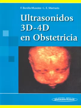 ULTTRASONIDO 3D Y 4D EN OBSTETRICIA