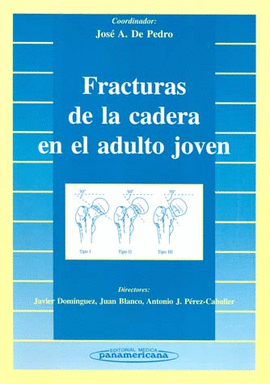 FRACTURAS DE LA CADERA EN EL ADULTO JOVEN