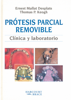 PROTESIS PARCIAL REMOVIBLE CLINICA Y LABORATORIO