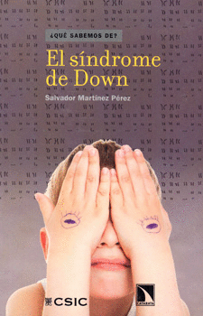 SINDROME DE DOWN, EL