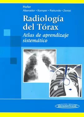 RADIOLOGÍA DEL TÓRAX. ATLAS DE APRENDIZAJE SISTEMÁTICO