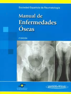 MANUAL DE ENFERMEDADES ÓSEAS