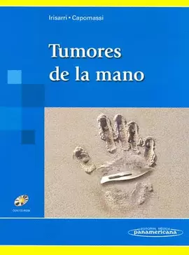 TUMORES DE LA MANO
