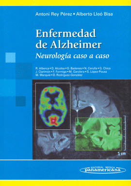 ENFERMEDAD DE ALZHEIMER. NEUROLOGÍA CASO A CASO