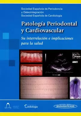 PATOLOGÍA PERIODONTAL Y CARDIOVASCULAR. SU INTERRELACIÓN E IMPLICACIONES PARA LA SALUD