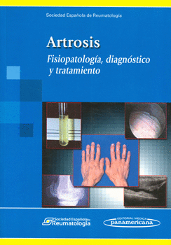ARTROSIS FISIOPATOLOGIA DIAGNOSTICO Y TRATAMIENTO
