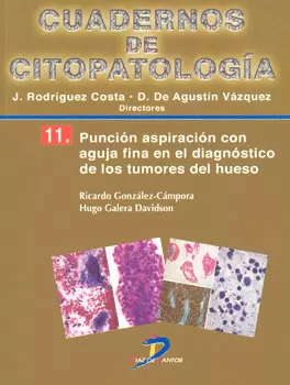 CUADERNOS DE CITOPATOLOGÍA 11 PUNCIÓN ASPIRACIÓN CON AGUJA FINA EN EL DIAGNÓSTICO DE LOS TUMORES DEL