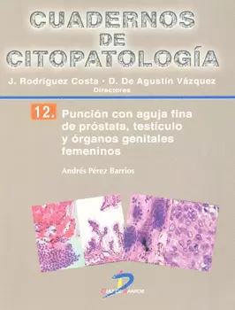 CUADERNOS DE CITOPATOLOGÍA 12 PUNCIÓN CON AGUJA FINA DE PRÓSTATA TESTÍCULO Y ÓRGANOS GENITALES FEMEN