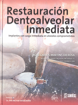 RESTAURACION DENTOALVEOLAR INMEDIATA