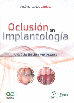 OCLUSION EN IMPLANTOLOGIA UNA GUIA SIMPLE Y MUY PRACTICA