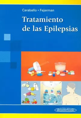 TRATAMIENTO DE LAS EPILEPSIAS