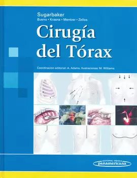 CIRUGÍA DEL TÓRAX
