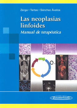 LAS NEOPLASIAS LINFOIDES MANUAL DE TERAPÉUTICA