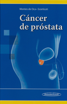 CÁNCER DE PRÓSTATA