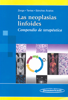 LAS NEOPLASIAS LINFOIDES COMPENDIO DE TERAPÉUTICA