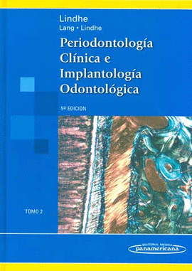 PERIODONTOLOGÍA CLÍNICA E IMPLANTOLOGÍA ODONTOLÓGICA. TOMO 2