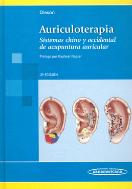 AURICULOTERAPIA