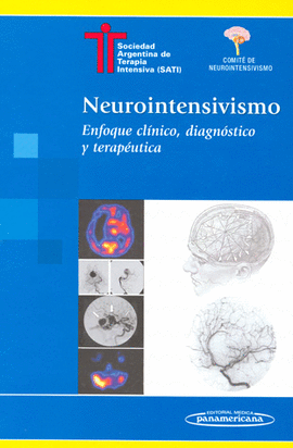 NEUROINTENSIVISMO