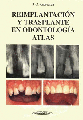 REIMPLANTACION Y TRASPLANTE EN ODONTOLOGIA ATLAS COLOR