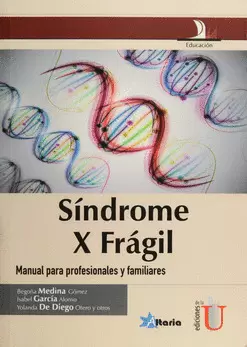 SÍNDROME X FRÁGIL