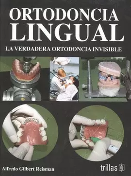 ORTODONCIA LINGUAL: LA VERDADERA ORTODONCIA INVISIBLE
