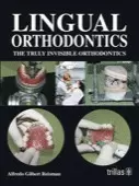 LINGUAL ORTHODONTICS: THE TRULY INVISIBLE ORTHODONTICS