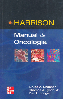 HARRISON: MANUAL DE ONCOLOGIA