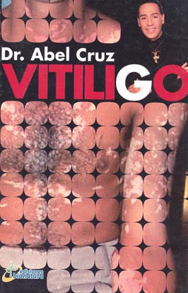 VITILIGO
