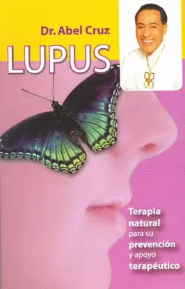 LUPUS