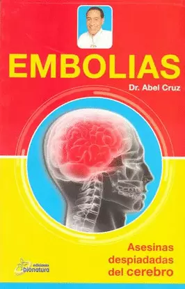 EMBOLIAS