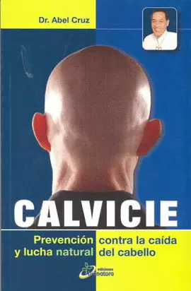 CALVICIE PREVENCION CONTRA LA CAIDA Y LUCHA NATURAL