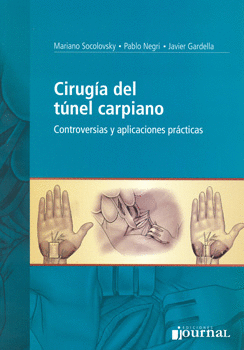 CIRUGIA DEL TUNEL CARPIANO CONTROVERSIAS Y APLICACIONES